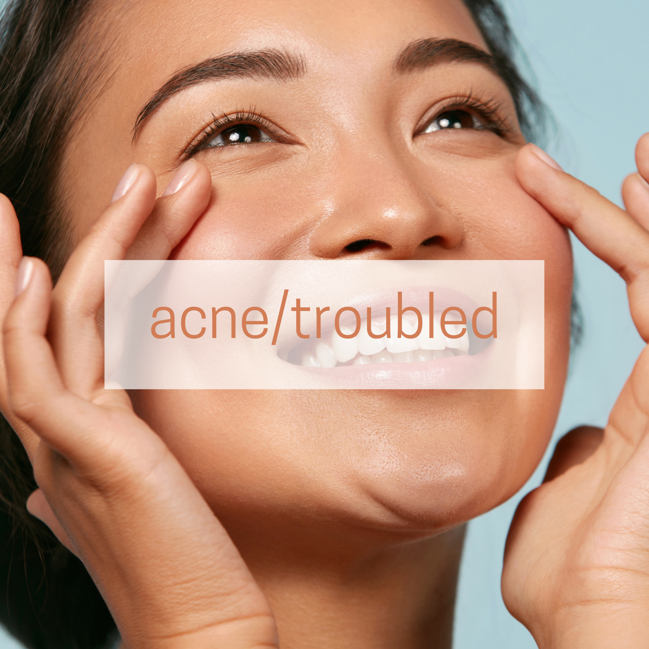 Acne/Troubled Skin